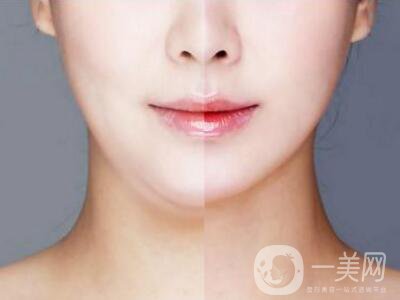 光纖溶脂減肥的危害主要有哪些？