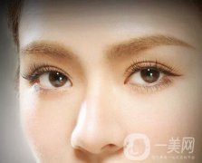 做了埋線多久能恢復(fù)自然？