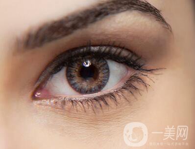 開眼角增生期多久消失？術(shù)后注意事項(xiàng)~