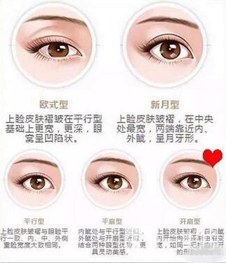 雙眼皮拆線后熱敷好嗎？