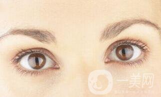 雙眼皮失敗修復(fù),雙眼皮失敗修復(fù)多少錢