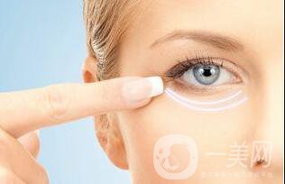 自體脂肪填充淚溝維持時(shí)間,自體脂肪填充淚溝價(jià)格