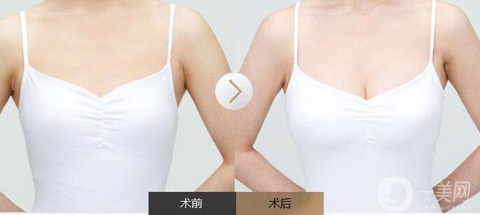 上海曙光醫(yī)院醫(yī)療美容整形價格表大透露