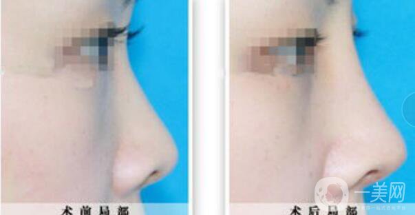 *整形,*整形多少錢(qián),北京*整形多少錢(qián)