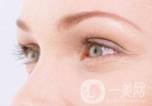 廣東玻尿酸去除魚尾紋多少錢,玻尿酸去除魚尾紋多少錢