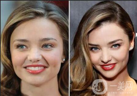 深圳去眼袋填淚溝手術(shù)一共需要多少錢(qián)