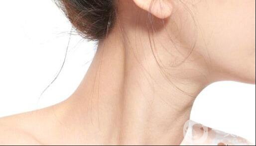 熱瑪吉去頸紋*果,熱瑪吉去頸紋