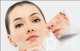 手術(shù)祛疤術(shù)后護(hù)理