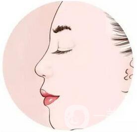 北京駝峰鼻矯正手術(shù)費(fèi)用大概有多少