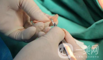 北京肋軟骨隆鼻價格一般是多少