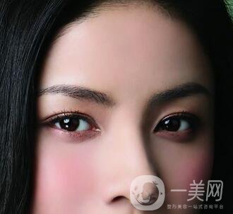 還在離不開雙眼皮貼嗎？雙眼皮手術(shù)助你雙眸