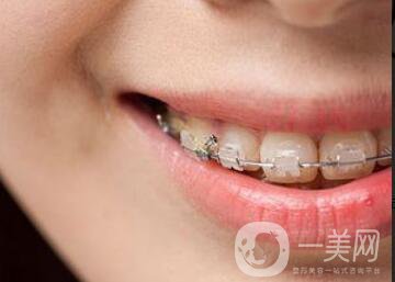 種植牙,種植牙注意事項(xiàng)