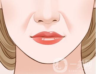 熱瑪吉去除法令紋