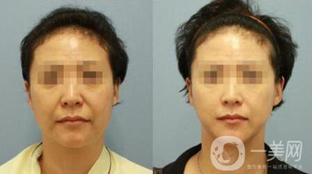 *注意事項及術后護理工作介紹