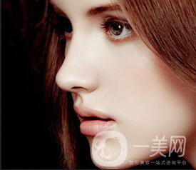 上海駝峰鼻矯正價錢