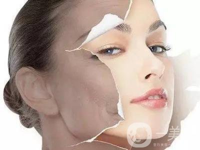 激光美白有什么副作用 有危害嗎