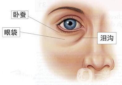 *去眼袋,*去眼袋價(jià)格