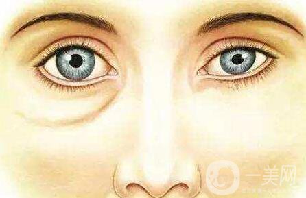 玻尿酸填充淚溝,玻尿酸填充淚溝價(jià)格