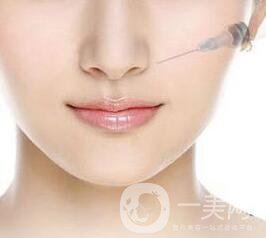 玻尿酸隆鼻多少錢