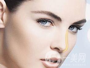 假體隆鼻多少錢