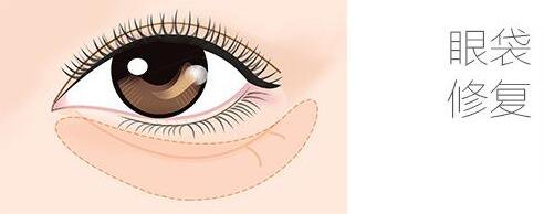 *去眼袋修復價格
