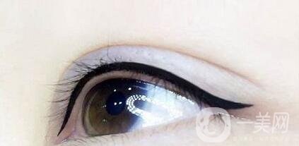 美瞳線修復的價格