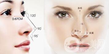 歪鼻矯正注意事項(xiàng)