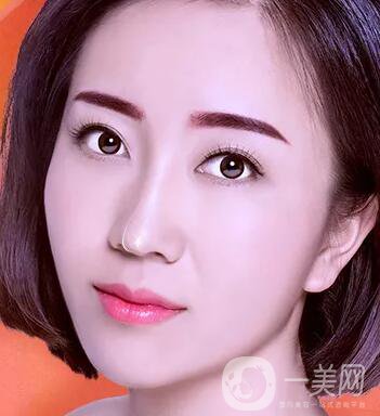 鼻頭縮小術(shù)注意事項