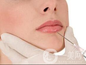 瑞蘭玻尿酸多少錢,瑞蘭玻尿酸