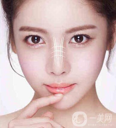 耳軟骨隆鼻多少錢(qián)