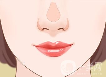 鼻翼縮小價(jià)錢