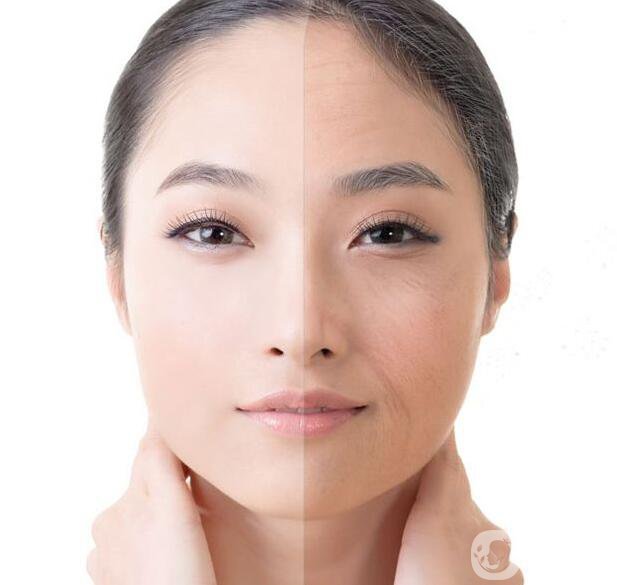 射頻和電波拉皮信息介紹