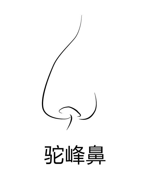 駝峰鼻矯正整形價格