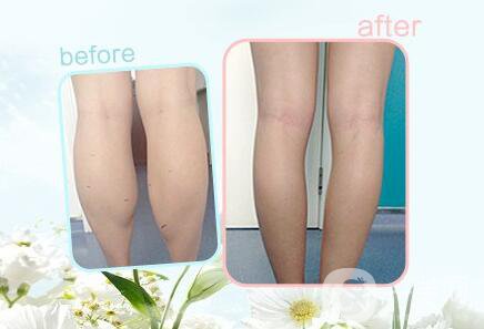 打*多少錢(qián)