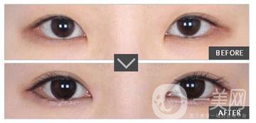 *修復(fù)價(jià)格