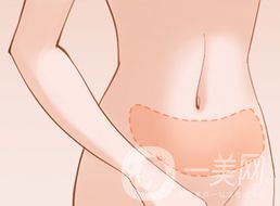 腹部溶脂恢復(fù)過程