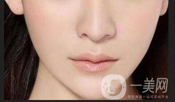 超聲法瘦臉,超聲法瘦臉價格