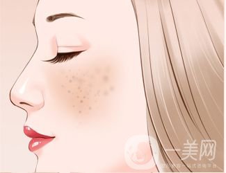 長了黃褐斑怎么辦 光子嫩膚調(diào)節(jié)黃褐斑價格