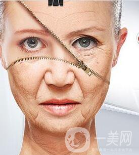 皮膚松弛與褶皺 射頻和電波拉皮信息介紹？