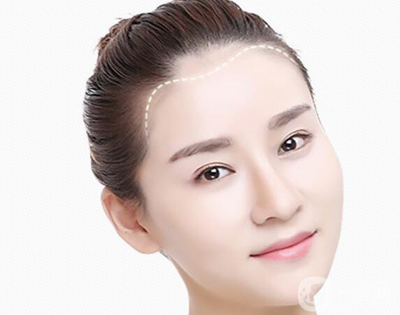 改發(fā)際線價格是多少？