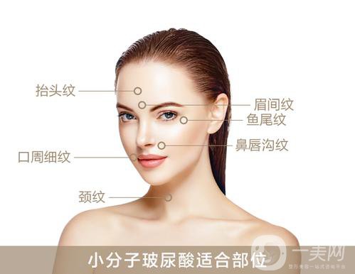 上海瑞蘭玻尿酸價格？*果怎么樣？