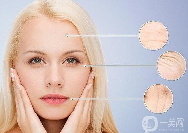 怎么去魚尾紋 去魚尾紋的方法