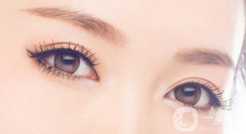 生物焊接雙眼皮多少錢？*果怎么樣？