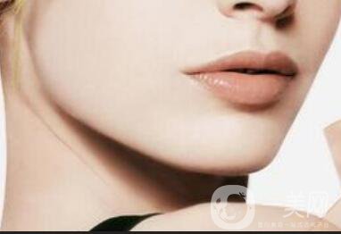 下頜角截骨,下頜角截骨術(shù)后護理方式