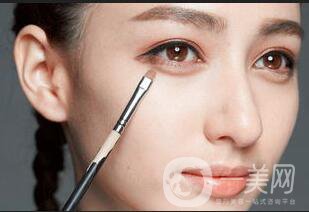 玻尿酸填充臥蠶價(jià)格,玻尿酸填充臥蠶風(fēng)險(xiǎn)