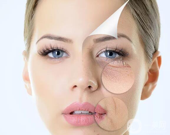 拉皮手術多少錢一次？