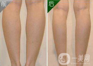 打*價(jià)錢 打*有用嗎