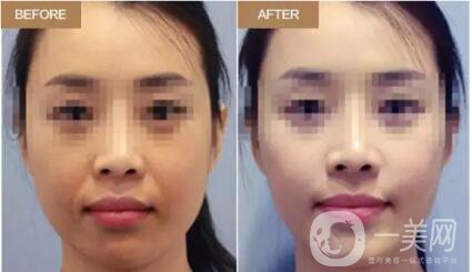 冬天應(yīng)該怎么護(hù)膚99%的人壓根就不知道，但這篇教你！