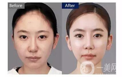 冬天應(yīng)該怎么護(hù)膚99%的人壓根就不知道，但這篇教你！