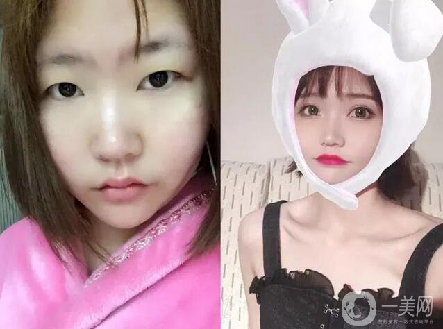 整容對人生的改變真的大嗎 整容后的人生變好了嗎